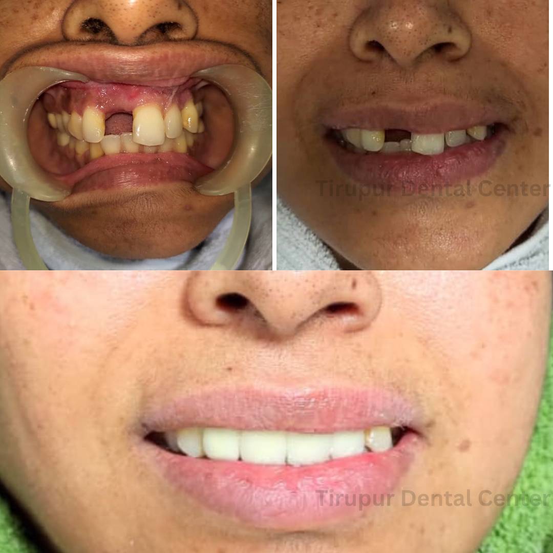 cosmetic dentistry (1)