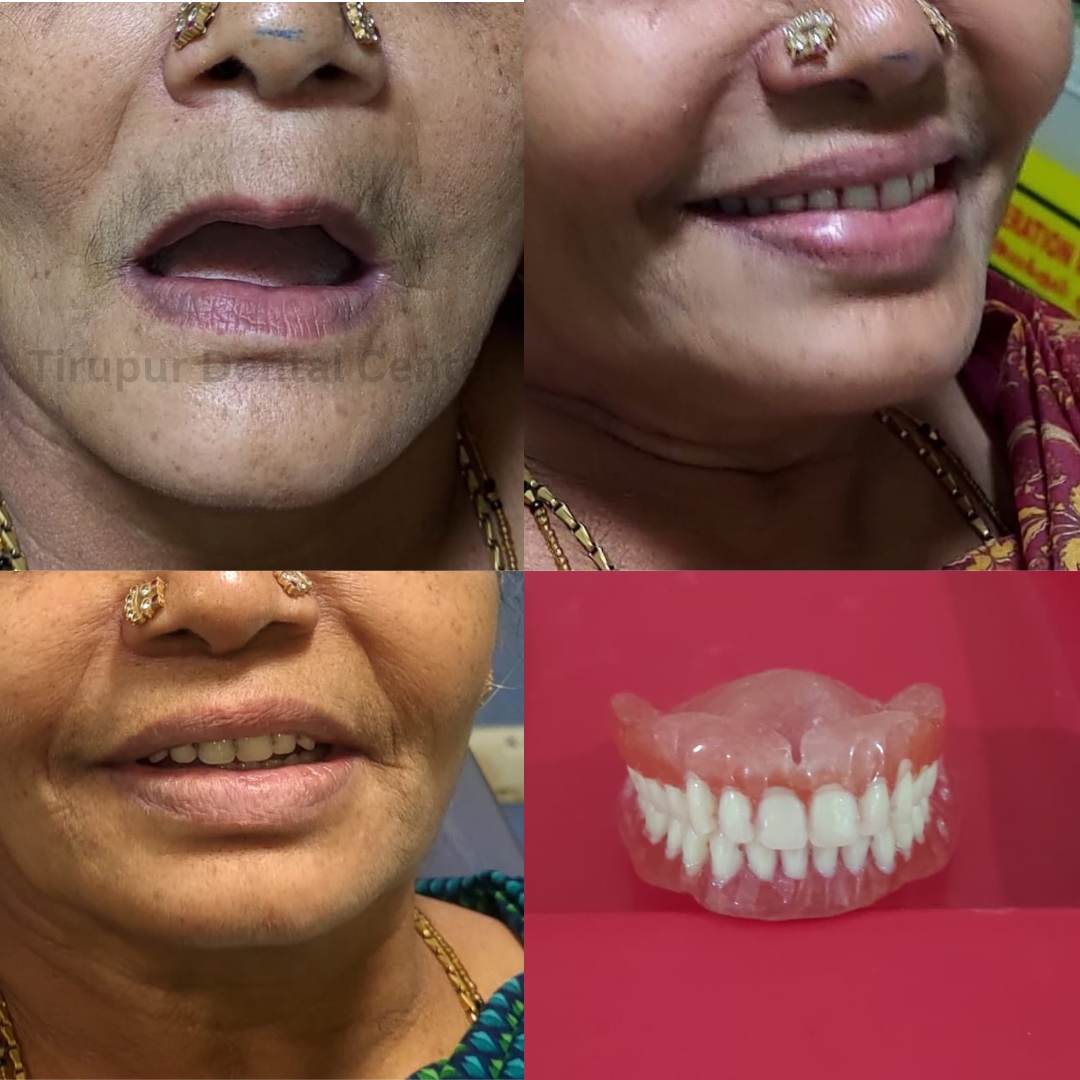 restorative dentistry